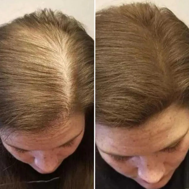 Hazel S. before and after