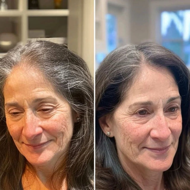 Amy G. before and after