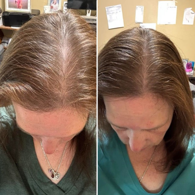 Charlotte M. before and after