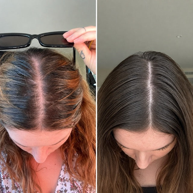 Dana H. before and after