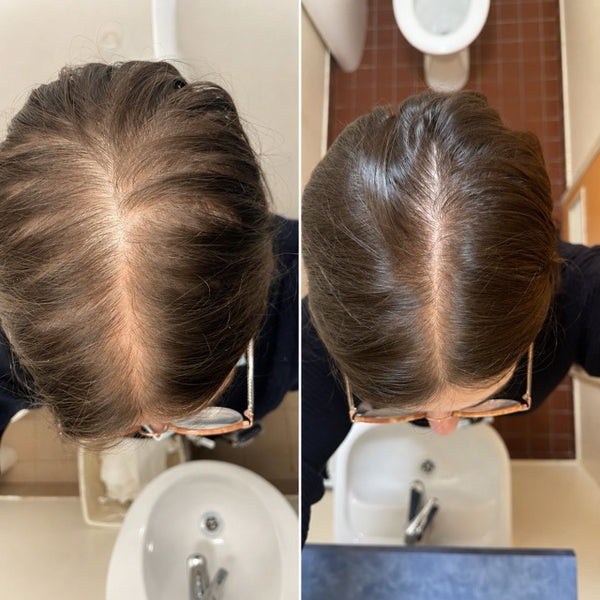 DENISE W. before and after