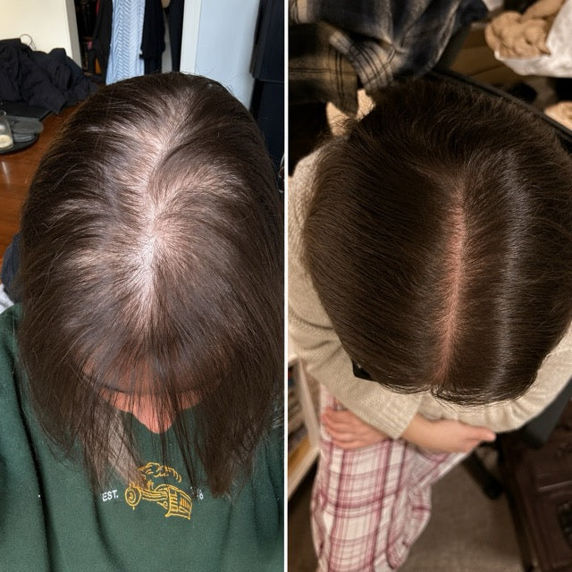 Karen M. before and after