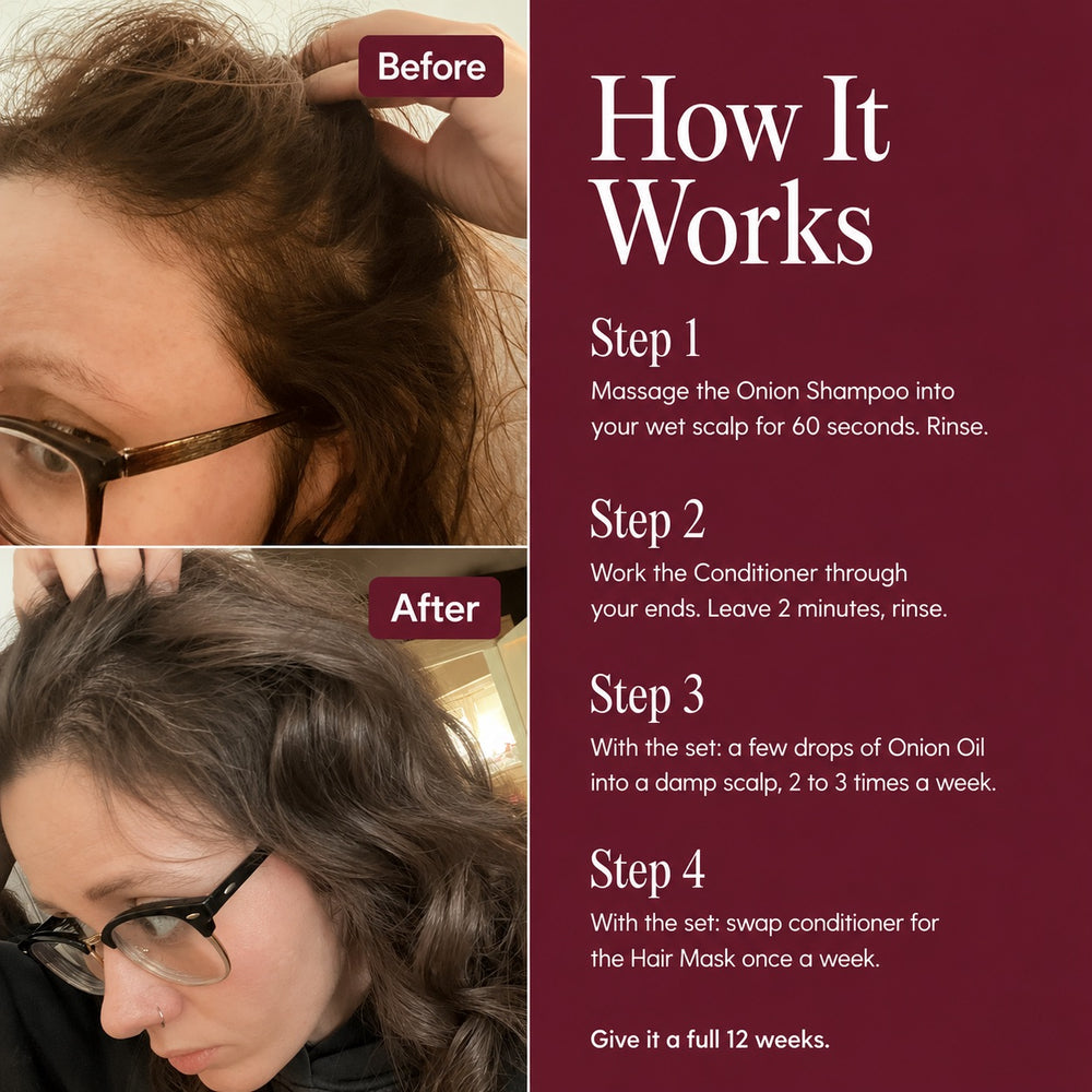 Nutrovela Onion Shampoo for Hair Loss & Thinning Hair