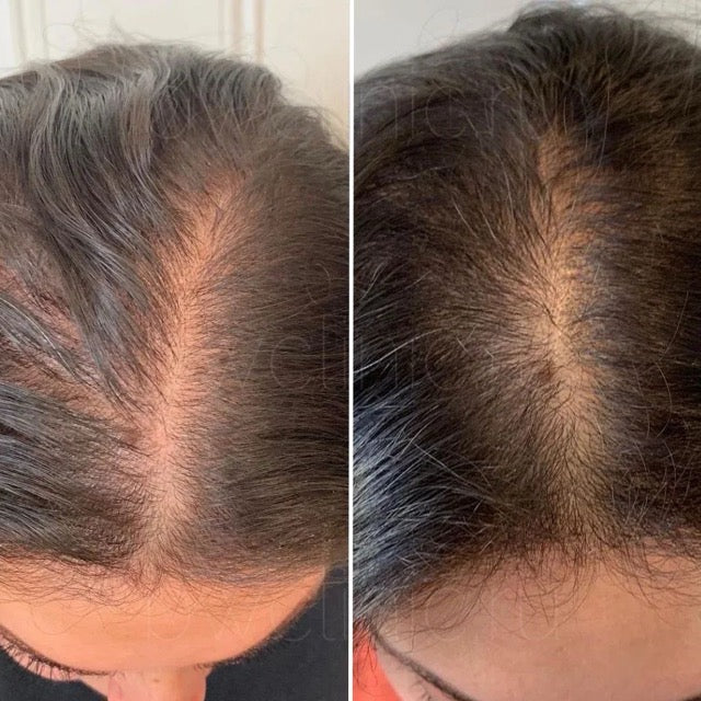 Shirley W. before and after