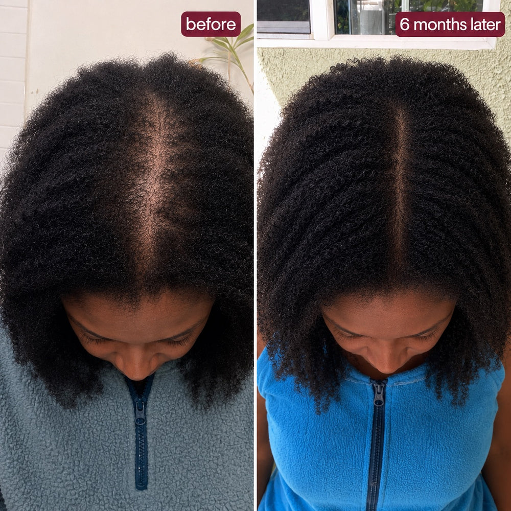 Nutrovela Onion Shampoo for Hair Loss & Thinning Hair