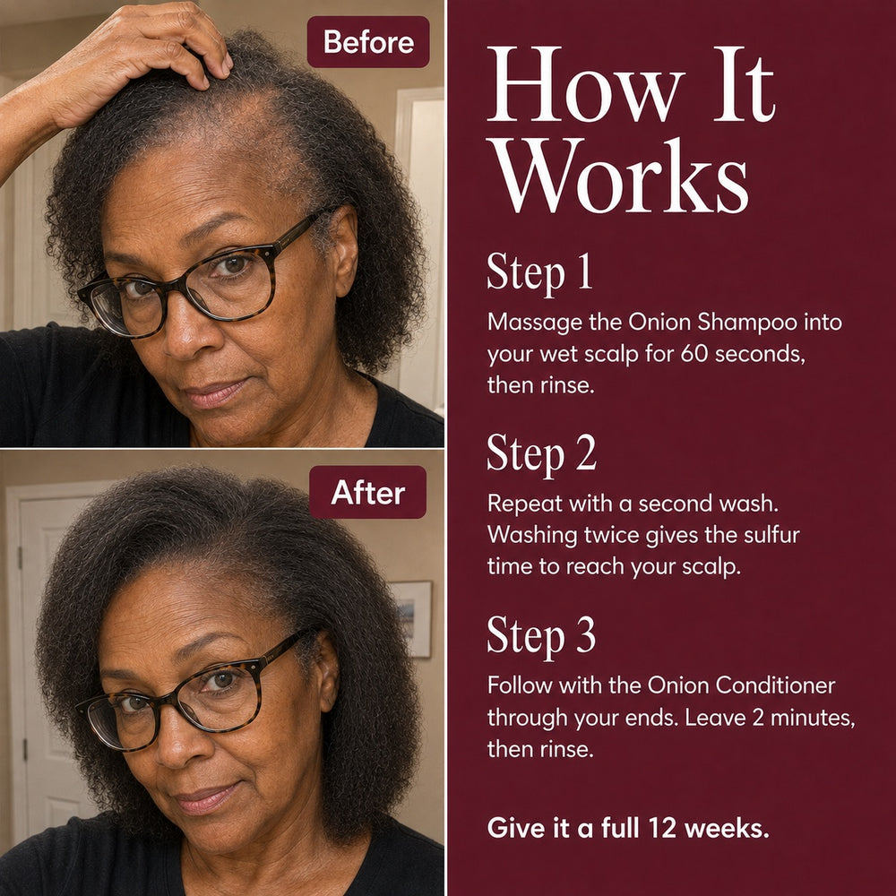 Nutrovela Onion Shampoo for Hair Loss & Thinning Hair