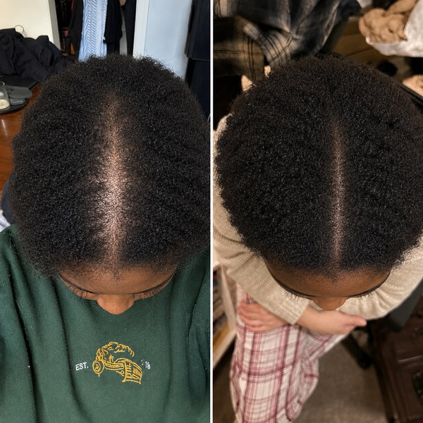 Ebony W. before and after