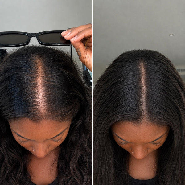 Keisha G. before and after