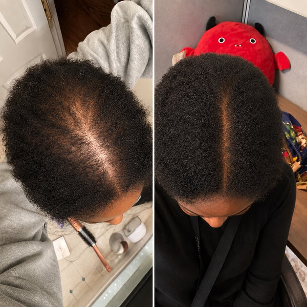 LATOYA M. before and after