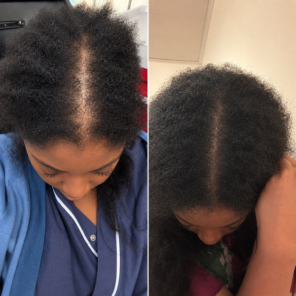 Aisha K. before and after
