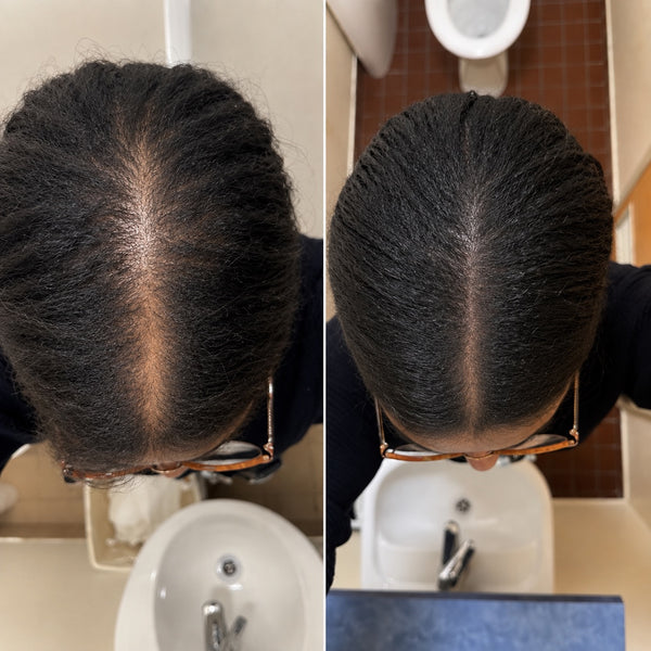 Tamika H. before and after