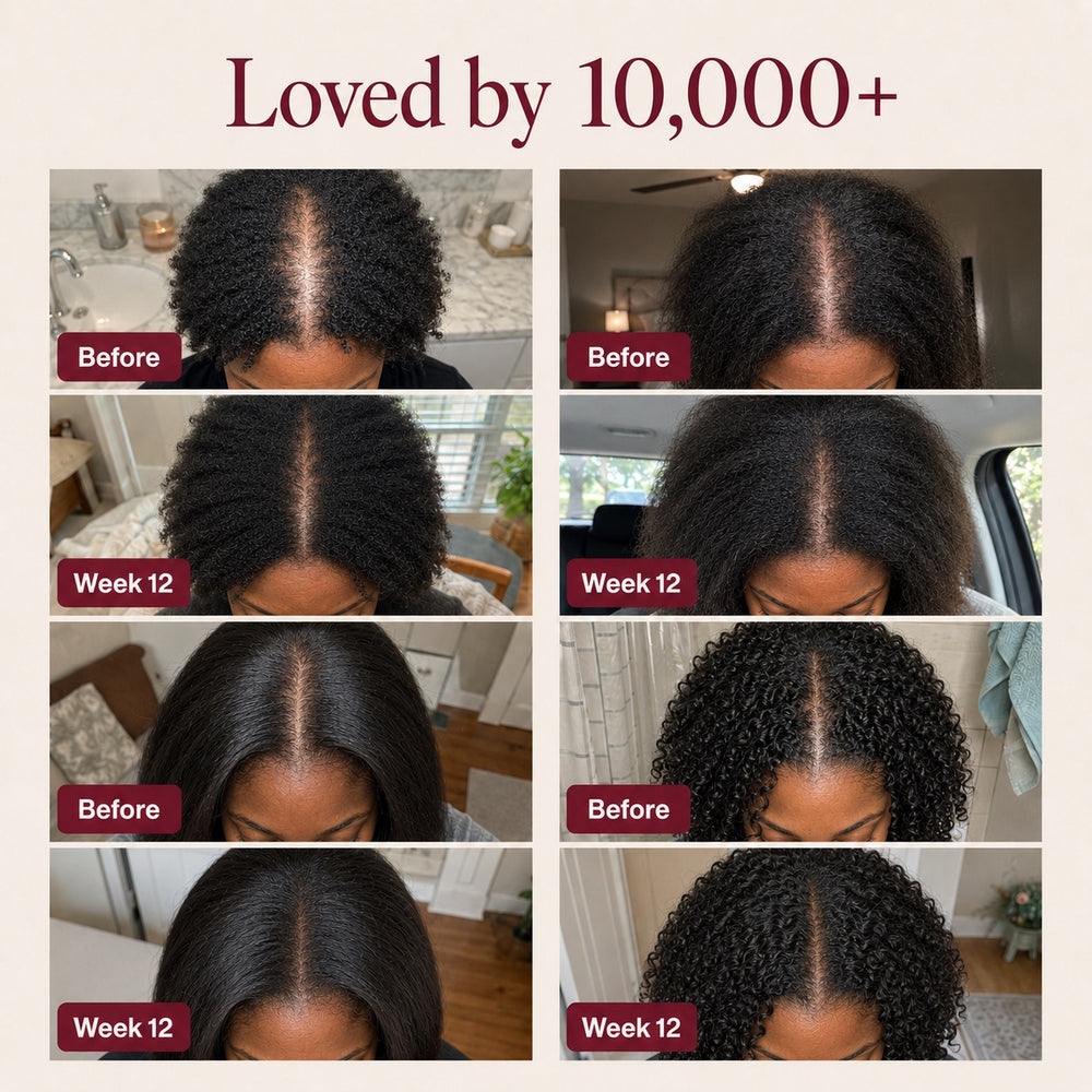 Nutrovela Onion Shampoo for Hair Loss & Thinning Hair