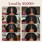 Nutrovela Onion Shampoo for Hair Loss & Thinning Hair
