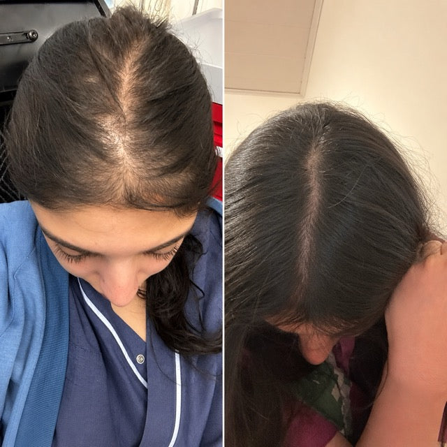 Simmy K. before and after