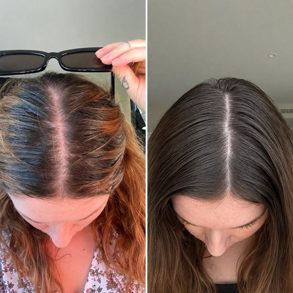 DANA H. before and after