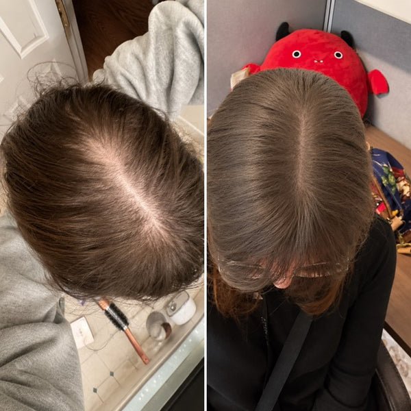 Barbra G. before and after