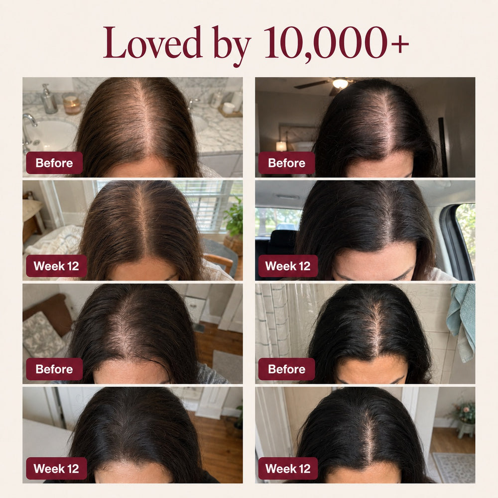 Nutrovela Onion Shampoo for Hair Loss & Thinning Hair