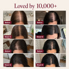 Nutrovela Onion Shampoo for Hair Loss & Thinning Hair
