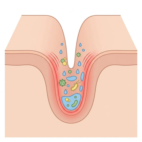 Why the Rash Keeps Coming Back