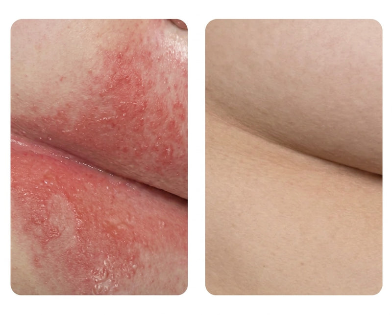 Before and after